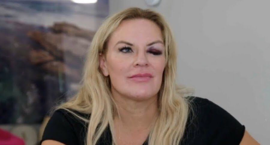 (Bravo) Somehow, Heather Gay is going to end up with a black eye on "The Real Housewives of Salt Lake City."