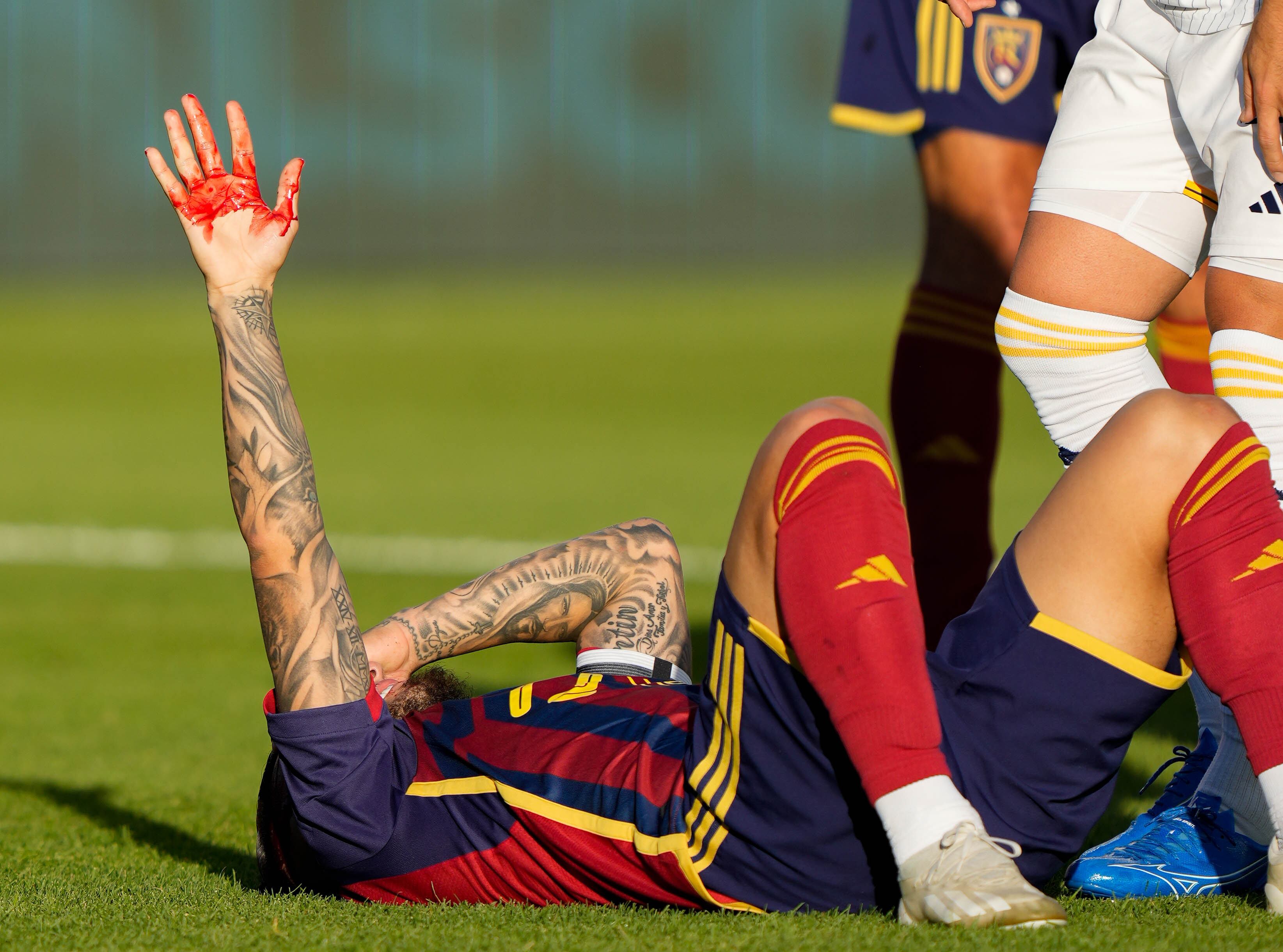 (Francisco Kjolseth | The Salt Lake Tribune) Real Salt Lake forward Chicho Arango (9) raises his bloody hand after colliding with Los Angeles Galaxy defender Martín Cáceres (22) during an MLS soccer match against LA Galaxy on Saturday, June 22, 2024, in Sandy Utah.