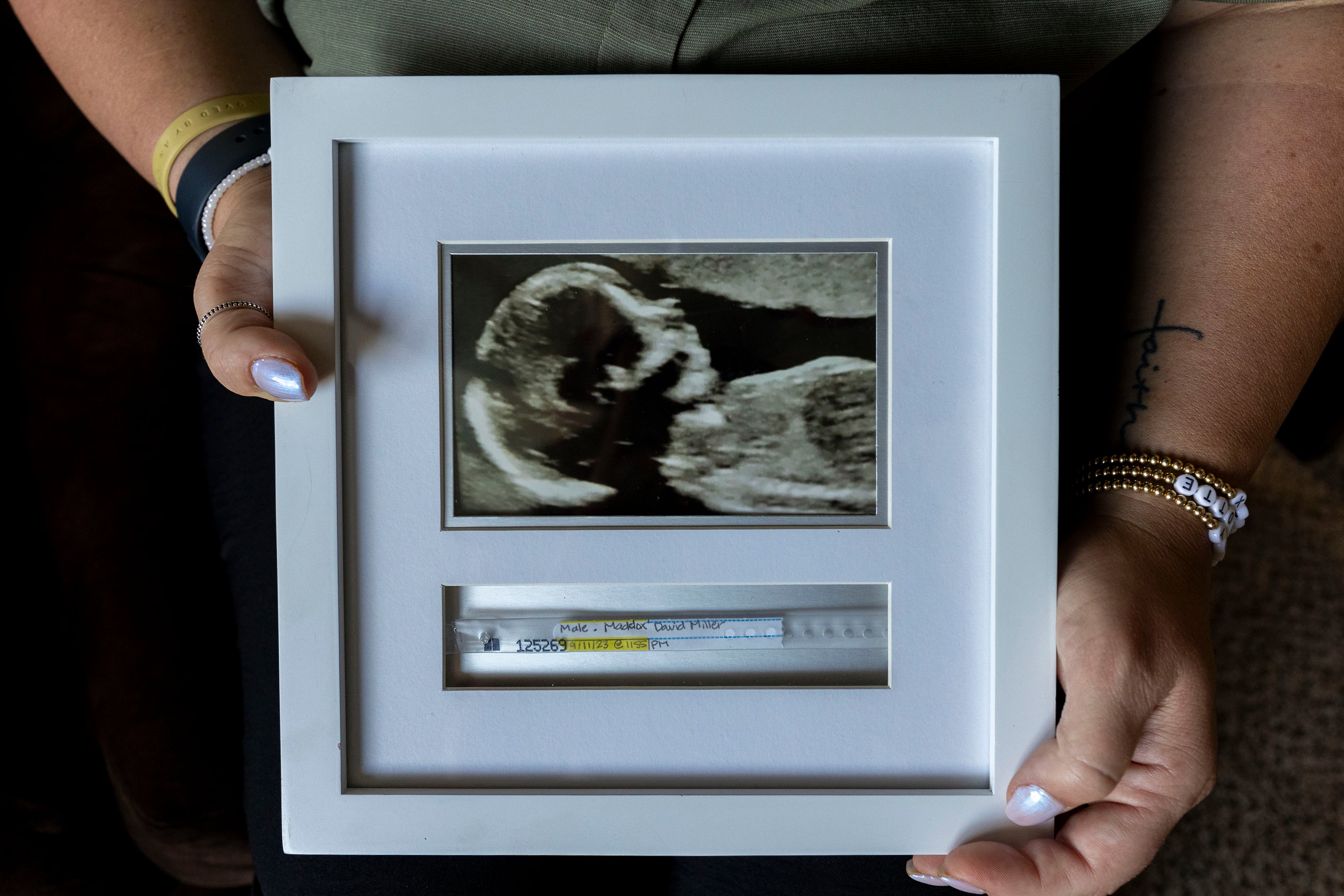 (Natalie Behring | The New York Times) Nicole Miller holds an ultrasound of her son in Meridian, Idaho, June 28, 2024. When she began hemorrhaging, Miller was taken by plane to Utah. Only when she woke up the next morning did she understand, because a nurse told her, that she was airlifted so she could have an abortion.